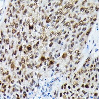 Immunohistochemistry-Paraffin: FOXO3 [p Ser425] Antibody - Azide and BSA Free [NBP3-16945]